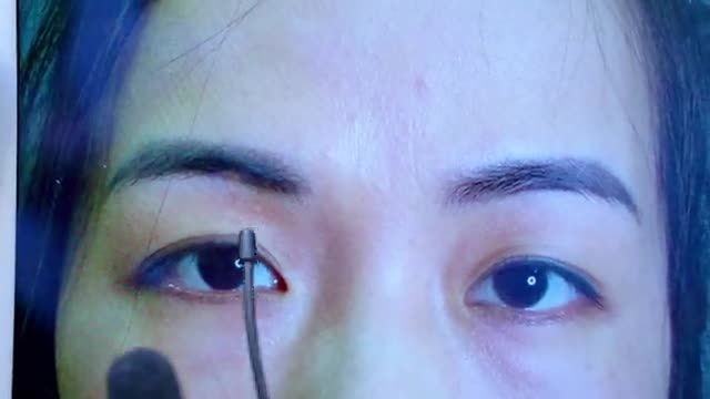 Dr.Hải Lê Top 1 thẩm mỹ mắt mang đến cho bạn sự trẻ trung rạng rỡ nhẹ nhàng từ đôi mắt sụp mí