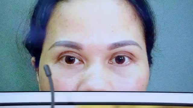 Đừng để mí hỏng khiến bạn tự ti, hãy để Dr.Hải Lê giúp bạn tự tin
