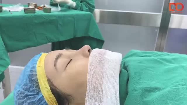 Khách hàng muốn sở hữu chiếc mũi CAO TỰ NHIÊN, MỀM MẠI, NHẸ NHÀNG.