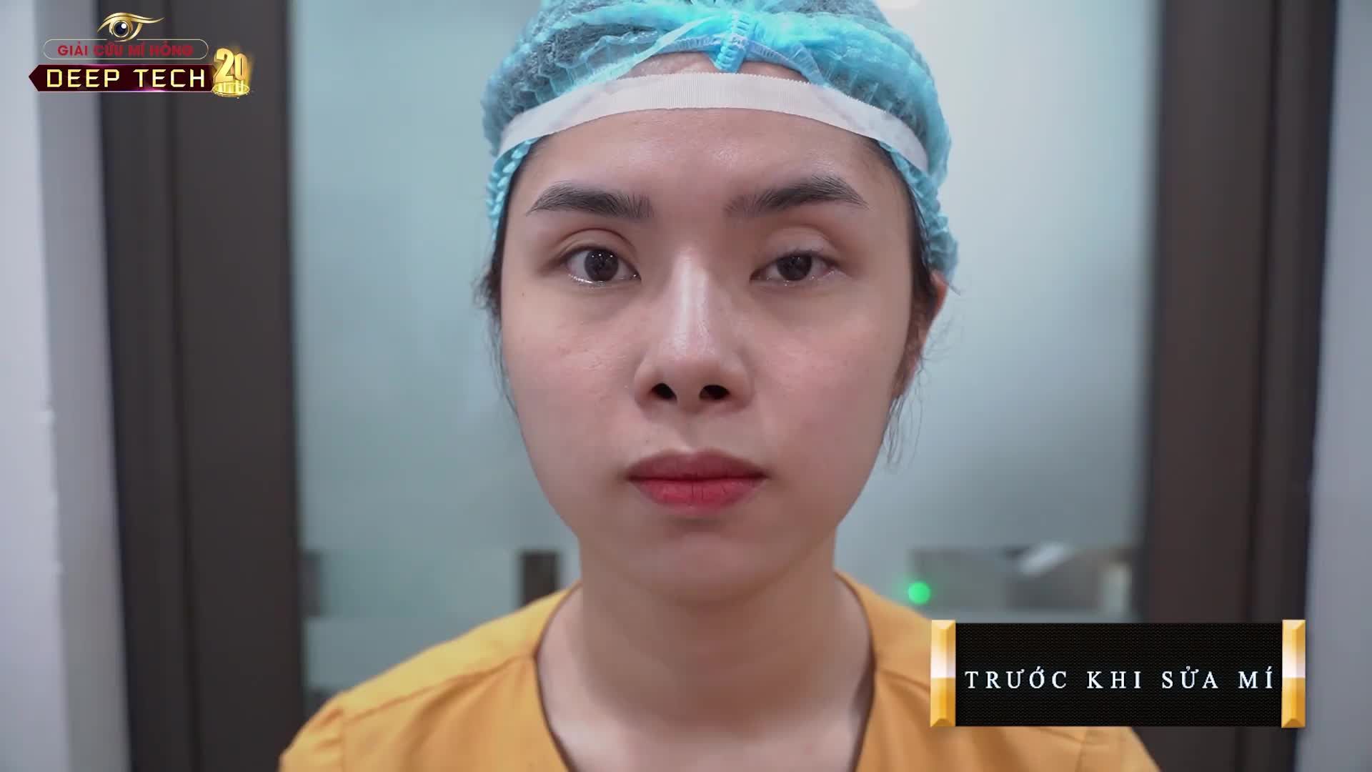 TÔI ĐÃ RẤT LO SỢ, STRESS VÀ GIẢM MẤT 5KG TRONG VÒNG 5 THÁNG VÌ TRÓT CẮT MÍ BỊ LỖI, HỎNG TRƯỚC ĐÓ.