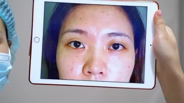Top 1 thẩm mỹ mắt Dr.Hải Lê sẽ mang đến cho bạn đôi mắt đẹp như thế nào? Mời các bạn cùng theo dõi video ngay sau đây