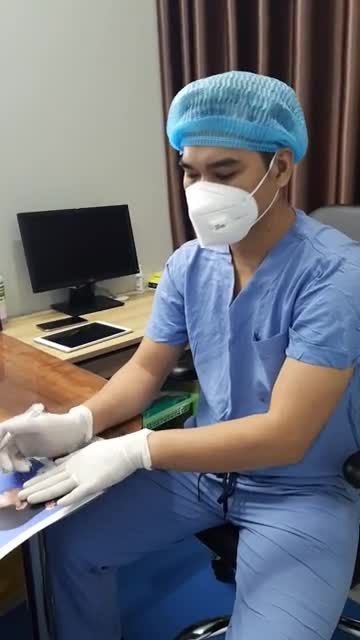 Phâ tích hình ảnh khách hàng chỉnh hàm hô trên dưới kết hợp trượt cằm