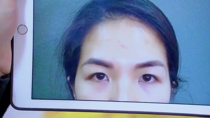 Combo Nâng cung mày + Cắt mí mang đến cho khách hàng vẻ đẹp rạng rỡ trẻ trung như thế nào? Theo dõi qua video sau đây.!