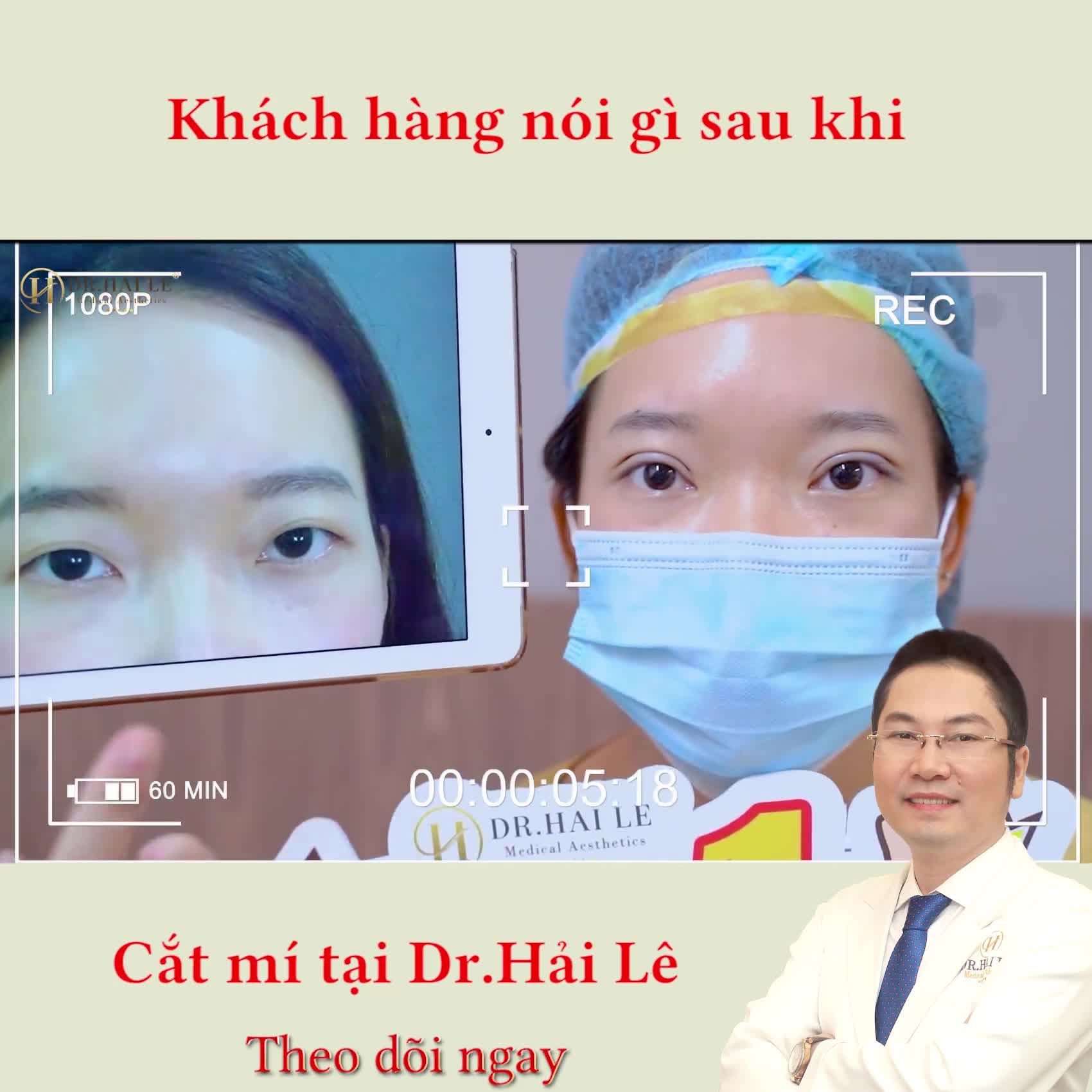 Cắt mí nhà Dr.Hải Lê xong, nàng ấy chấm 10/10 điểm đó cả nhà ạ