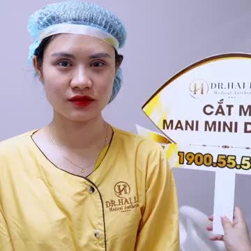 Khách hàng hạnh phúc khi ngắm mình trong gương sau 45 phút thực hiện tiểu phẫu Cắt mí tại Dr.Hải Lê