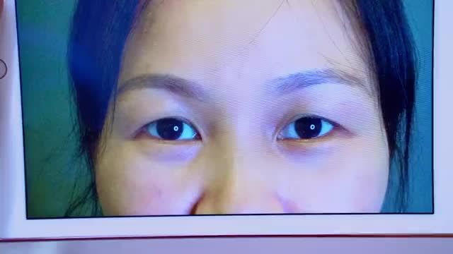 Nâng cung mày giúp đôi mắt trẻ hóa 5-10 tuổi bạn có tin? Chưa tin thì phải theo dõi hết video này bạn nhé
