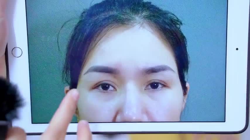 Mắt sụp mí già nua cải thiện bằng phương pháp nào hiệu quả? Mời cả nhà cùng đón xem