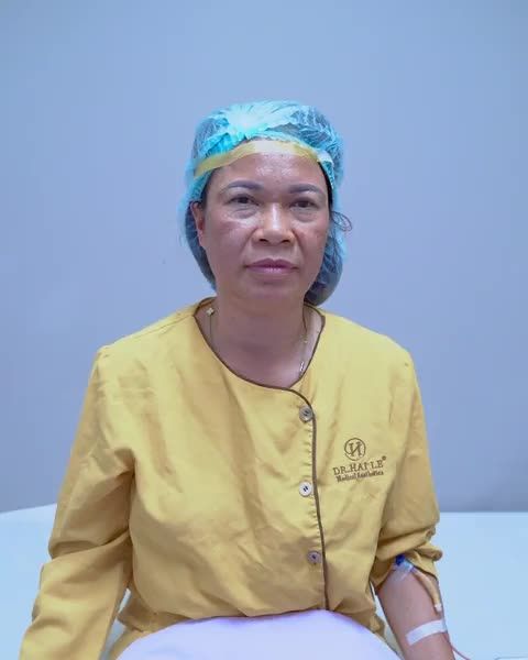 Khắc phục da phủ sụp mí giúp vị khách hàng cải thiện tầm nhìn - Mời quý khách hàng cùng theo dõi