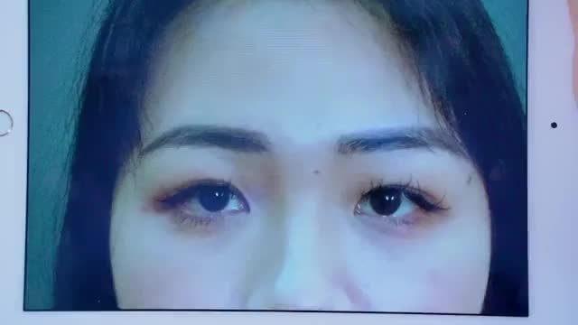Cô nàng "Mắt hí" chỉ sau 1h đến Dr.Hải Lê hóa mí 2 mí rạng rỡ sang chảnh là ai? Mời cả nhà cùng đón xem!