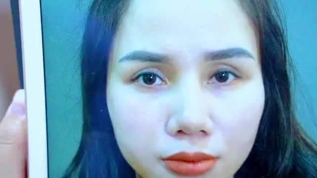 Mí mắt lỗi hỏng sửa bằng phương pháp nào hiệu quả nhất hiện nay? Mời quý khách hàng cùng theo dõi