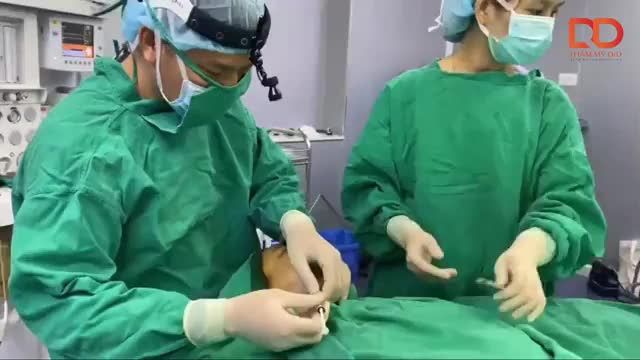 Cấy mỡ toàn mặt - Tạo hình khuôn mặt baby, đầy đặn, da căng bóng, mịn màng.
