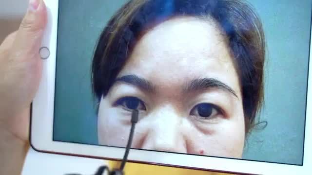 "Không nghĩ làm mí lại đẹp tự nhiên mà trẻ ra nhiều thế, biết thế này mình làm lâu rồi" cùng nghe vị khách hàng chia sẻ cảm nhận sau tiểu phẫu Cắt mí tại Dr.Hải Lê