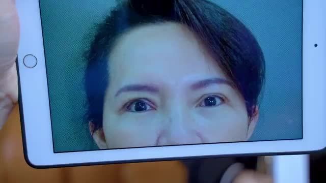 Mí mắt lỗi hỏng bạn đừng quá lo lắng hãy trao niềm tin cho Dr.Hải Lê Hải Lê sẽ trao cho bạn sự tự tin.!