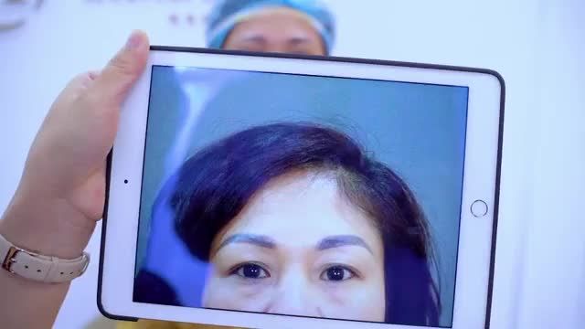 Ca Nâng cung mày giúp khách hàng trẻ hơn, rạng rỡ hơn, xinh hơn chỉ sau hơn 30 phút thực hiện