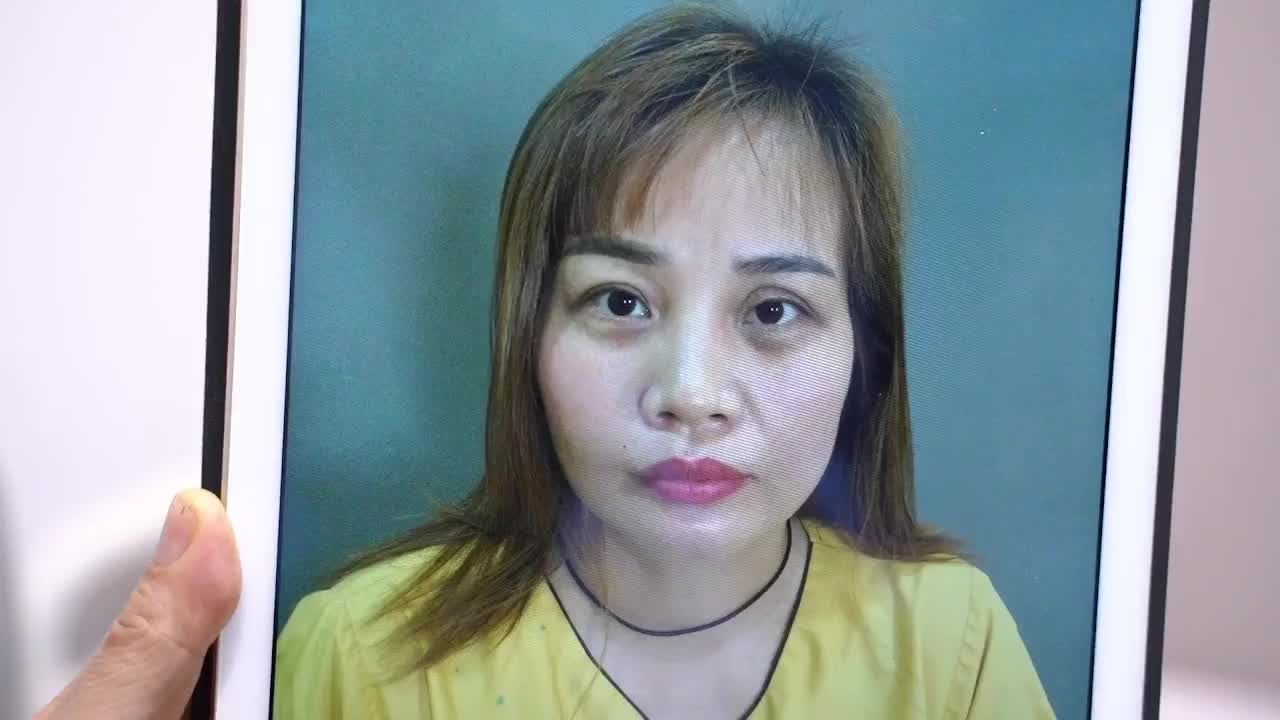 Trót cắt mí lỗi hỏng tại cơ sở kém uy tín. Phải làm sao? Review "chất như nước cất" sau khi sửa mí của KH dành cho Dr.Hải Lê. Mời cả nhà cùng theo dõi!