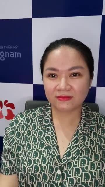 U32 sẽ thay đổi như thế nào sau Cắt mí?
