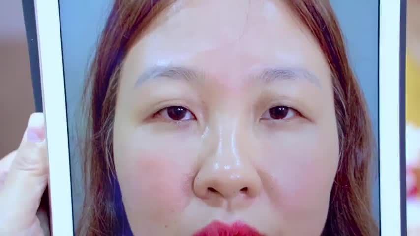 Mắt nhỏ sụp mí, da phủ mí dày được khắc phục như thế nào tại Dr.Hải Lê? Mời quý khách hàng cùng theo dõi