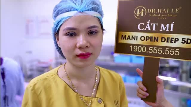 Mắt tròn xinh, mí rạng ngời chỉ có thể là kết quả do đội ngũ Bác sĩ tại Dr.Hải Lê thực hiện