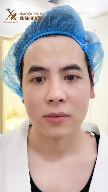 TRẺ HÓA BẤT NGỜ SAU 1 GIỜ NÂNG CƠ, DA CĂNG MỊN KHÔNG CÒN NẾP NHĂN"