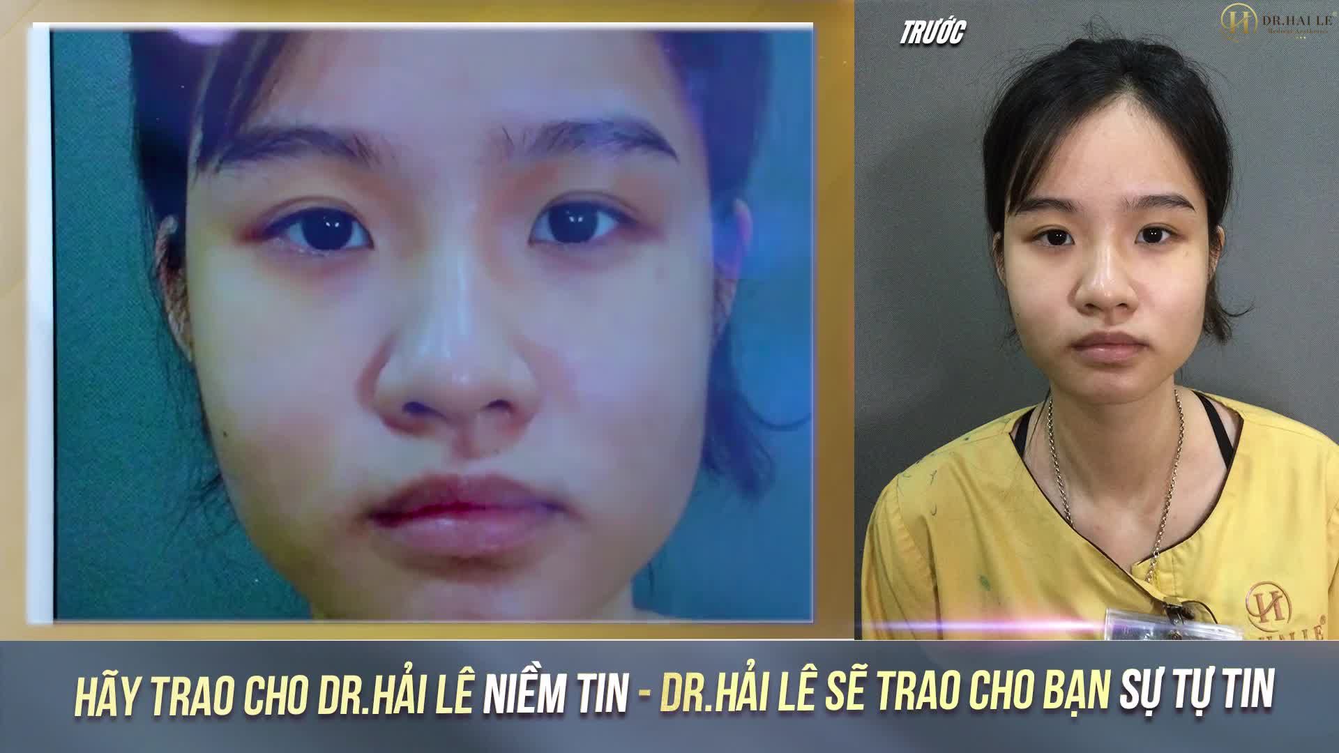Trên đời này nhất định phải có một đôi mắt thật xinh xắn, trong trẻo nha các nàng
