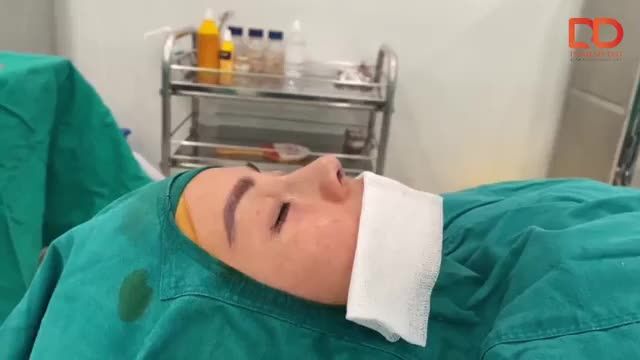 Khách hàng thực hiện combo nâng mũi Perfect Dform + cắt mí dưới Elite Eyes tại Thẩm mỹ DrD.