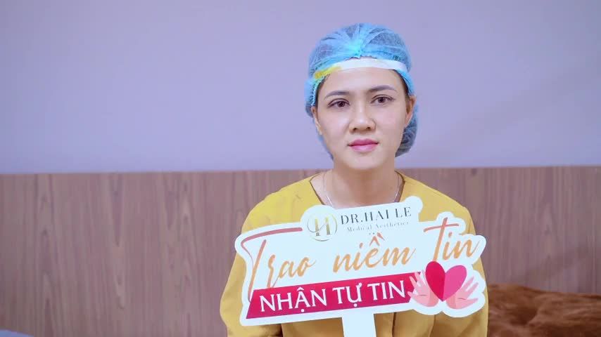 Mí mắt sẹo do từng mọc "Mụn L.ẹo" gây biến dạng mí mắt có chỉnh hình đẹp tự nhiên tại Dr.Hải Lê được không?