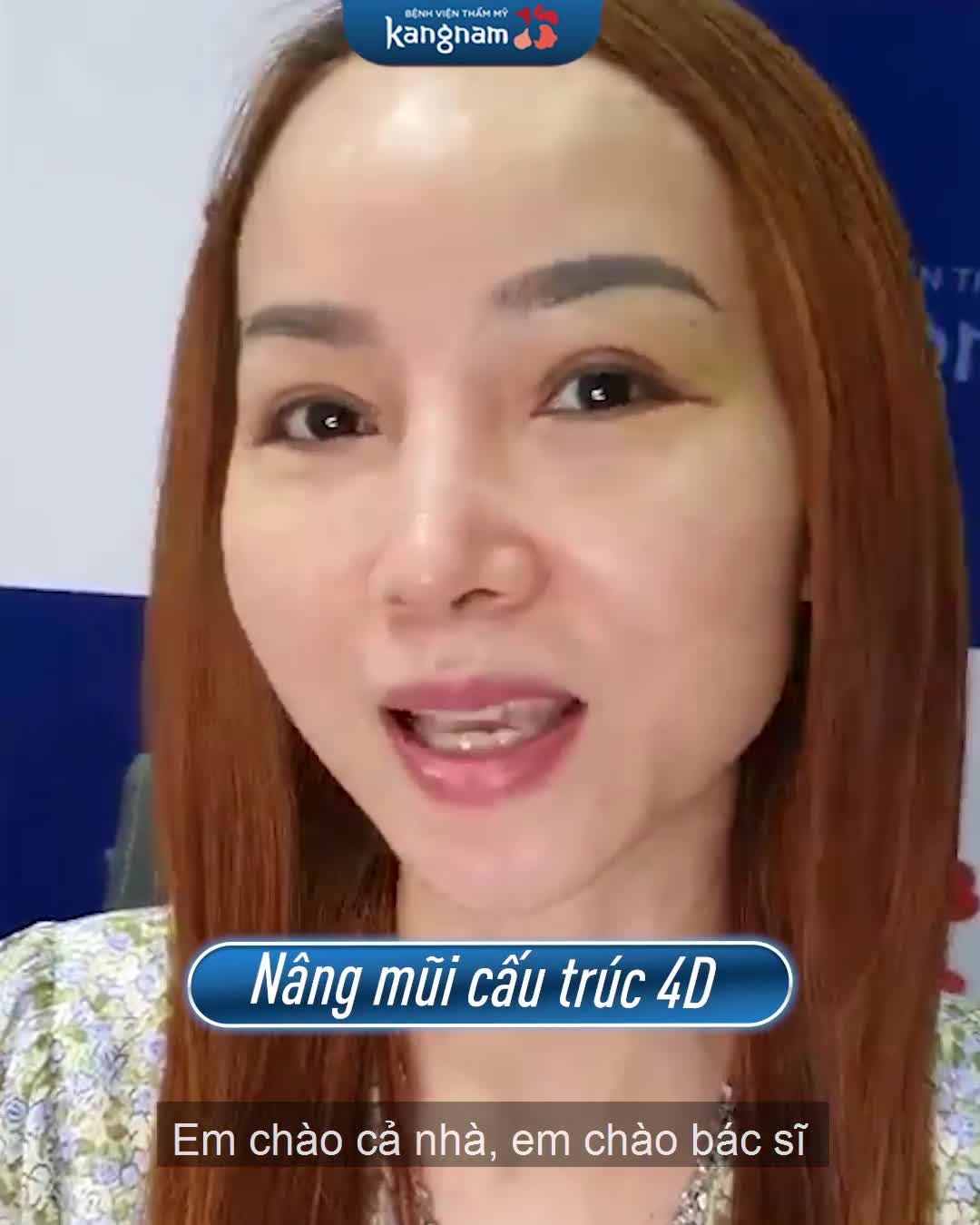 Khách hàng Việt kiều khen nức nở sau Nâng mũi tại Kangnam