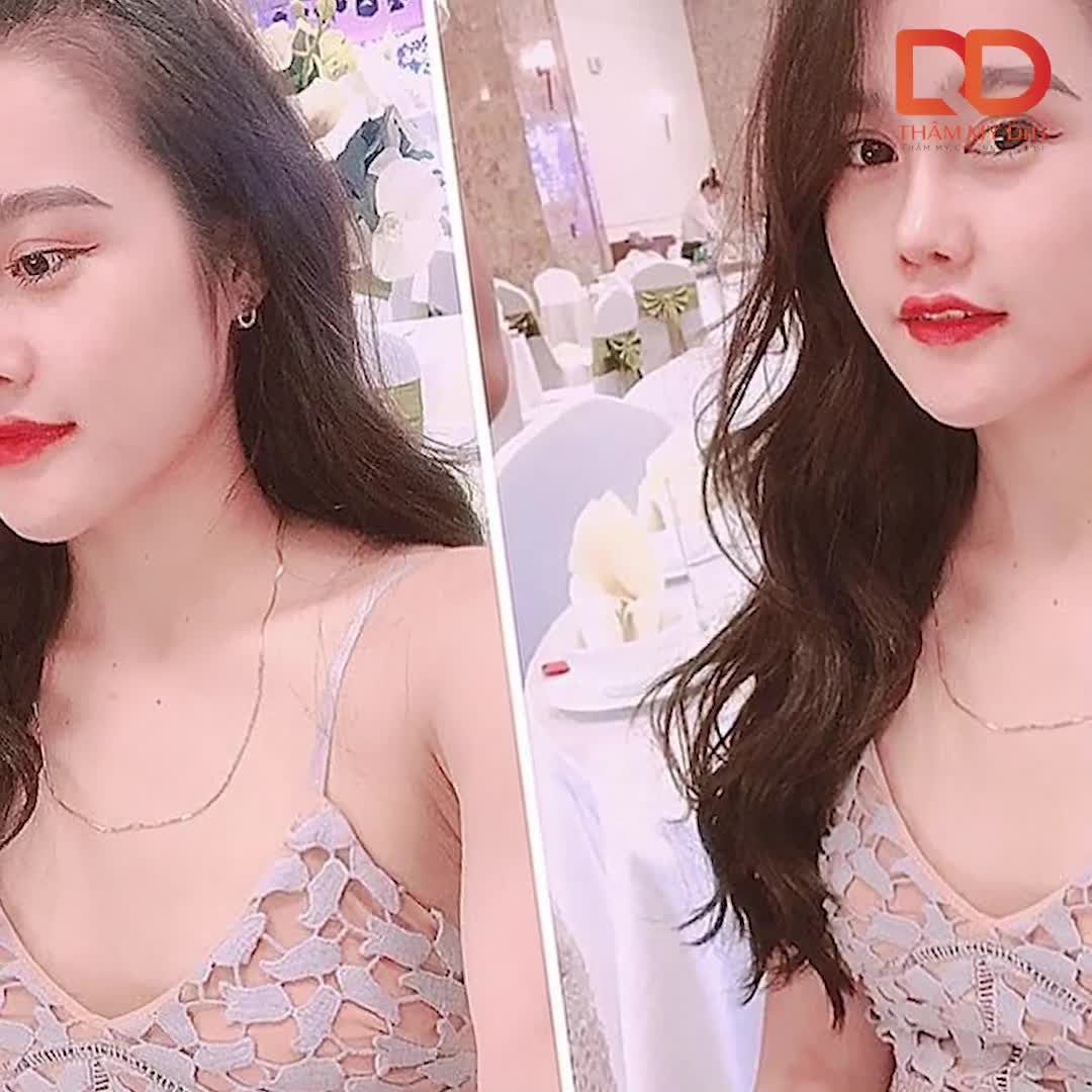 Nhật kí bye bye "màn hình phẳng" của cô nàng Đoàn Ngân