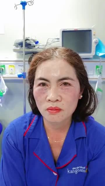 Kết quả sau 45p CĂNG CHỈ MI YOUNG - Cô khách trẻ đẹp bất ngờ, cảm ơn rối rít bác sĩ!!