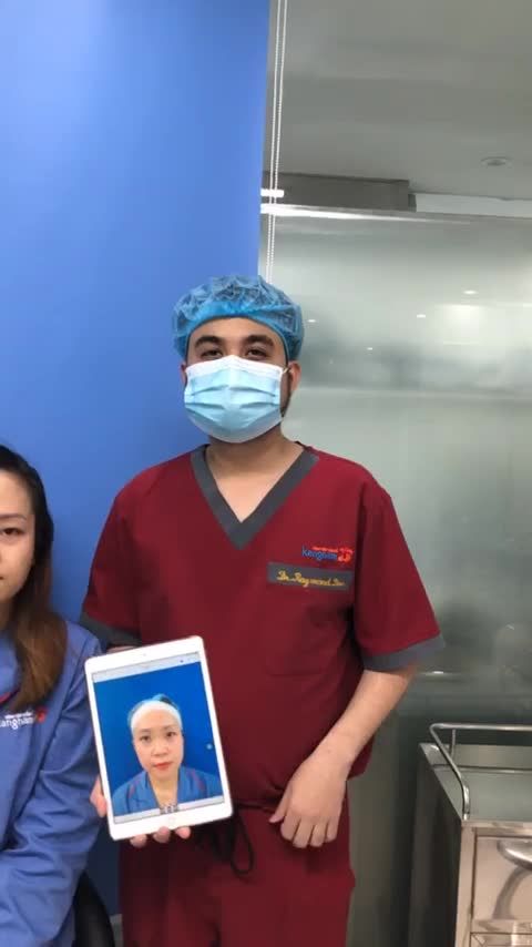 Cận cảnh Nâng mũi cấu trúc 4D trước và sau