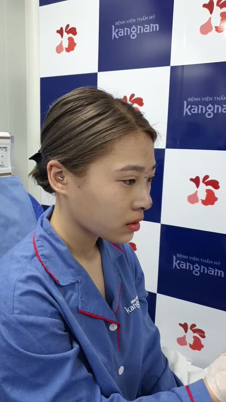 “ƯỚC MƠ dáng mũi cao xinh, giờ tới Kangnam mới thực hiện được” - chị KH chia sẻ