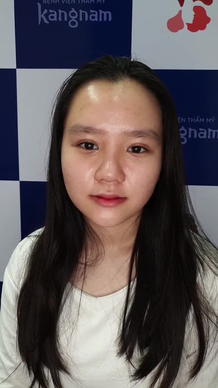 Bạn nữ đợi đủ 18 tuổi đi CẮT MÍ và cái kết xinh ngỡ ngàng