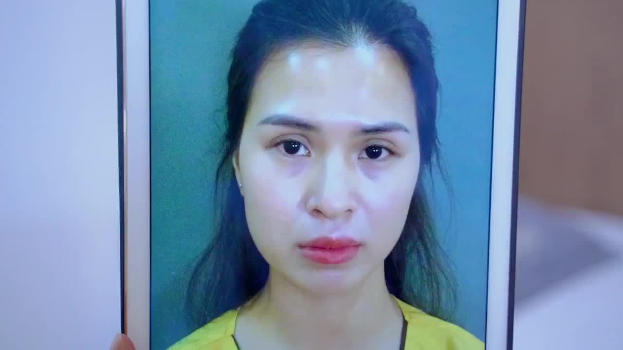 Chiêm ngưỡng ngay tác phẩm sau Sửa mí của chị khách hàng dưới đây để cùng chứng thực về tính ưu Việt của công nghệ sửa mí Deep Tech20 tại VTM Dr.Hải Lê!