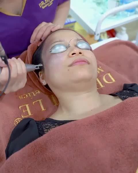 Điều trị chàm bớt bẩm sinh có khỏi được không?