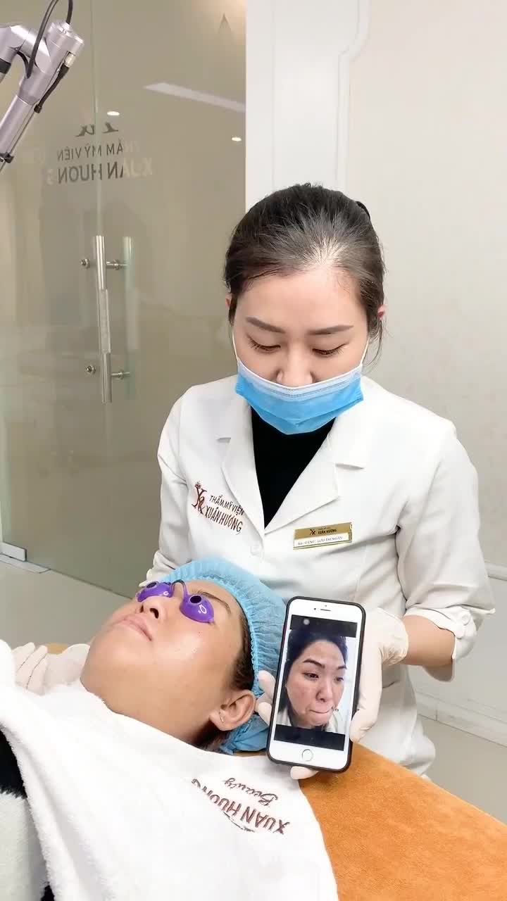 TRỊ DỨT ĐIỂM MỤN THÂM CÙNG CÔNG NGHỆ CAO, HIỆU QUẢ NHANH MÀ DA CÒN TRẺ HÓA