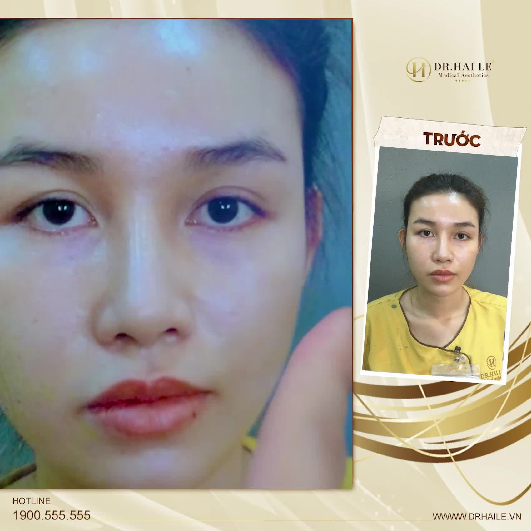 Bạn ấy nói Em quá tin tưởng Bác sĩ Hải Lê rồi, nên em không lo lắng hay băn khoăn gì cả.