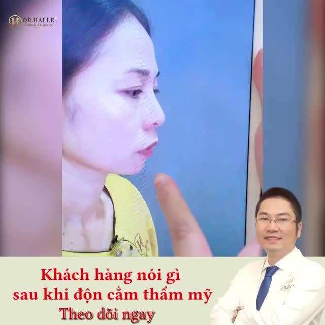 ĐỘN CẰM V-LINE - TRỞ THÀNH PHIÊN BẢN ĐẸP NHẤT CỦA CHÍNH MÌNH