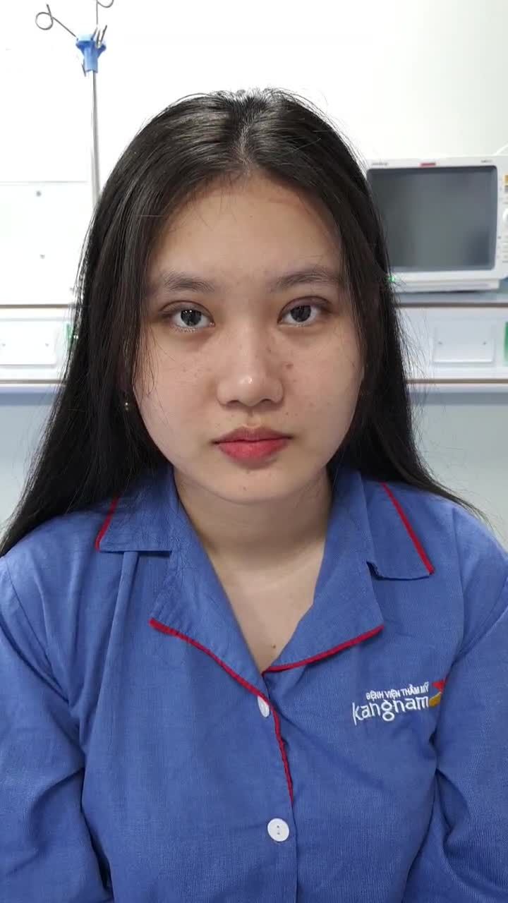 Cắt mí to tròn trẻ trung, nâng cấp nhan sắc kịp tết với dịch vụ cắt mí trên plasma