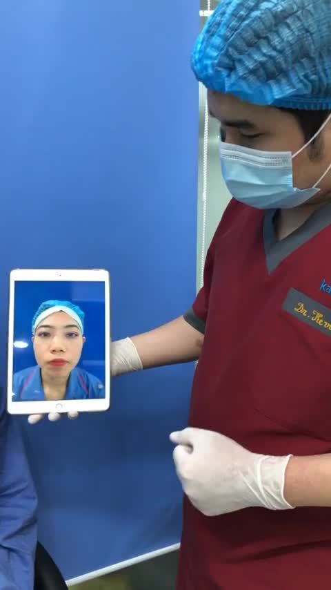 Nâng mũi Cấu trúc 4D ngay lúc này tại BVTM Kangnam Hà Nội 190 Trường Chinh