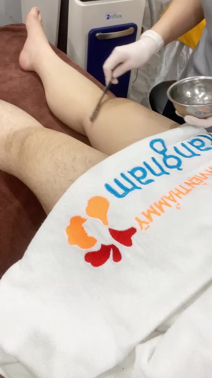 Triệt lông chân công nghệ Diode Laser cao cấp