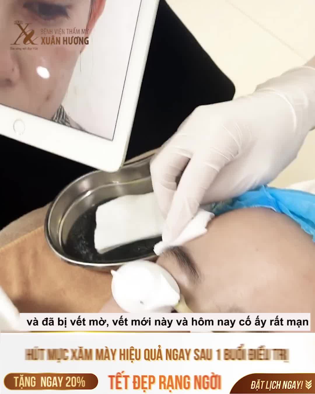 HÚT MỰC XĂM MÀY TẠI NHIỀU NƠI NHƯNG KHÔNG HẾT,  ĐẾN XUÂN HƯƠNG ƯNG Ý QUÁ, KHÁCH HÀNG LIỀN CHO QUAY VIDEO ĐỂ KIỂM CHỨNG KẾT QUẢ