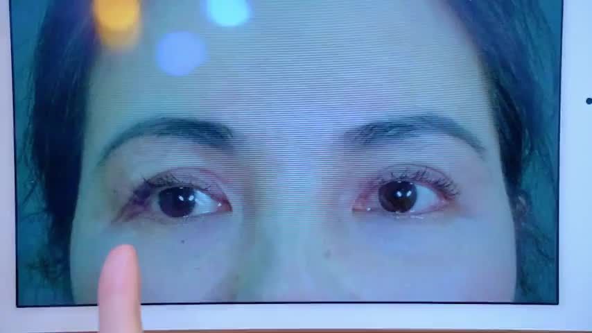Đừng ngại thay đổi nếu mắt bạn gặp tình trạng lỗi hỏng