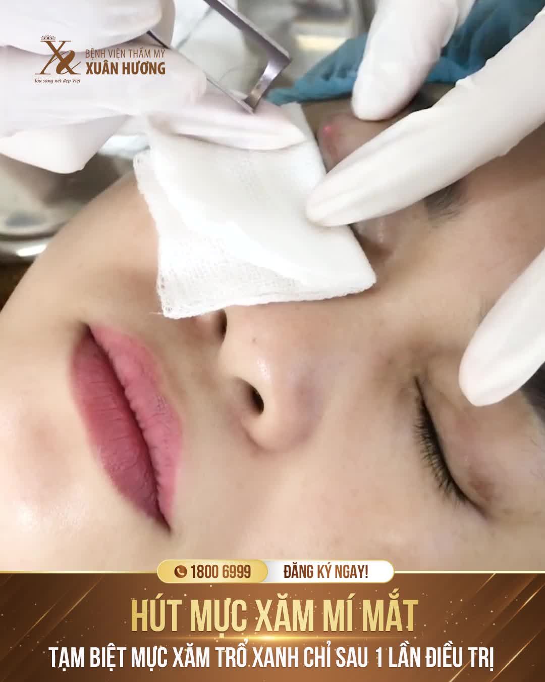 MỰC XĂM MÍ PHAI XANH NHIỀU NƠI KHÔNG DÁM XÓA  ĐẾN XUÂN HƯƠNG, LOẠI BỎ SẠCH SẼ CHỈ SAU 1 LẦN