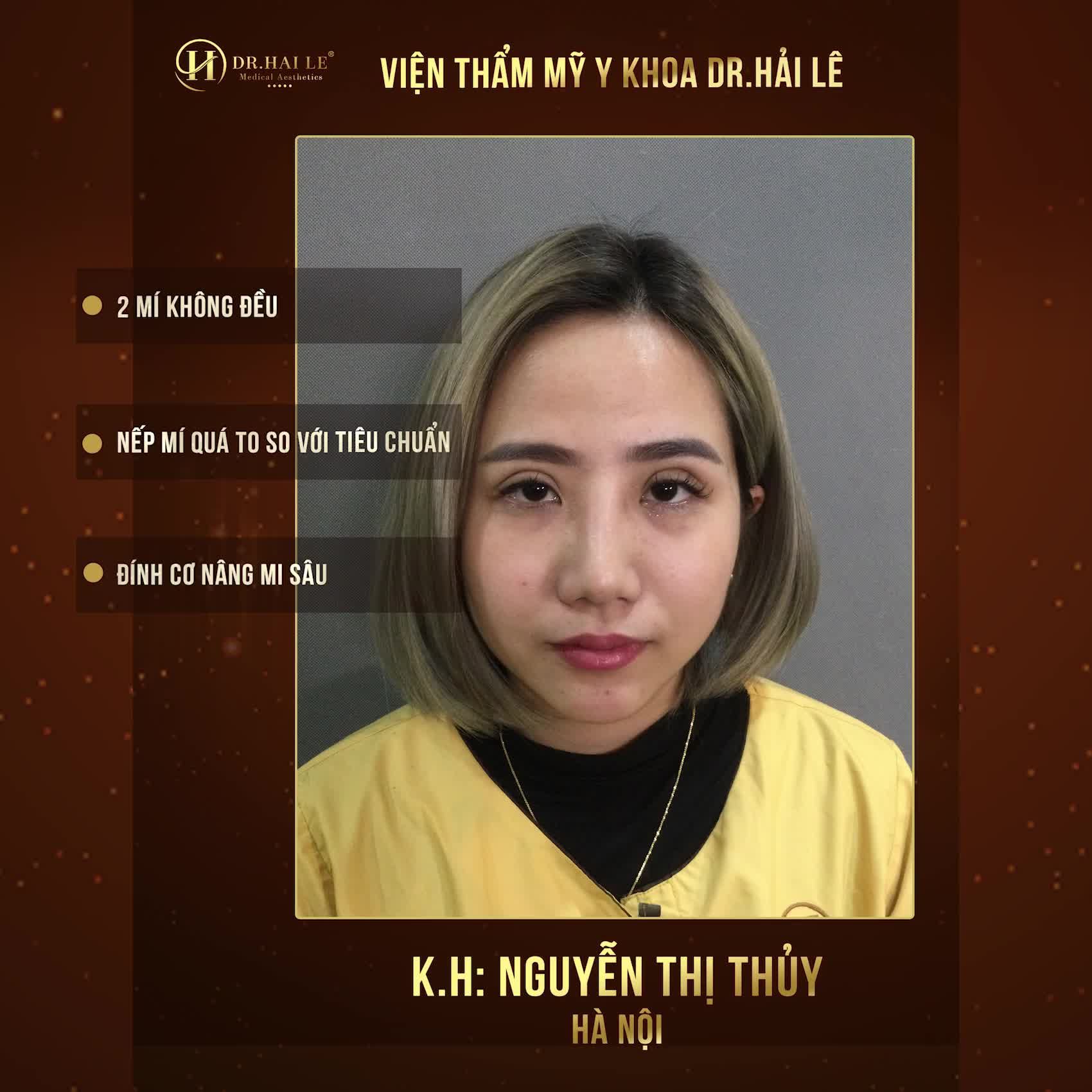 Nghe đồn Thẩm mỹ bây giờ TẾT sẽ đẹp