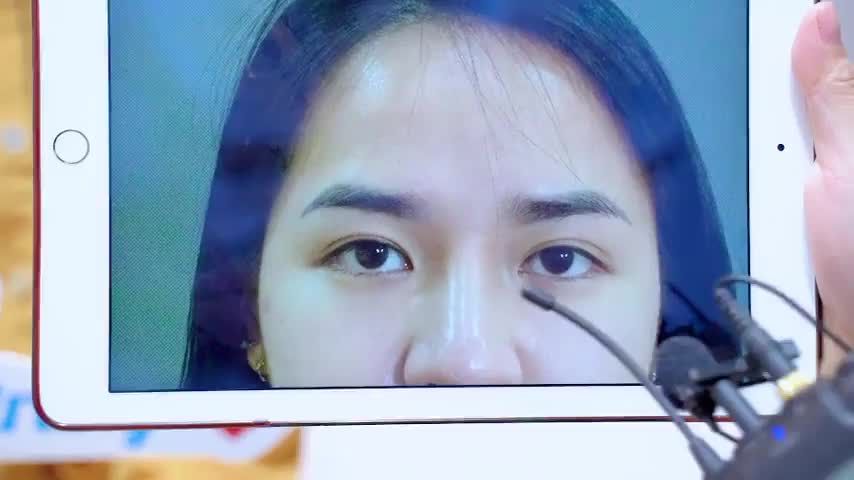 Cắt mí có đẹp không Câu trả lời sẽ có tại video này bạn nhé