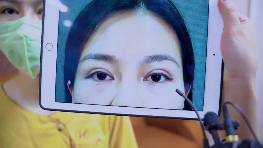 Đừng để mắt lỗi hỏng khiến bạn tự ti hãy để đôi mắt đẹp tự nhiên tươi trẻ mà Dr.Hải Lê mang đến giúp bạn tự tin!