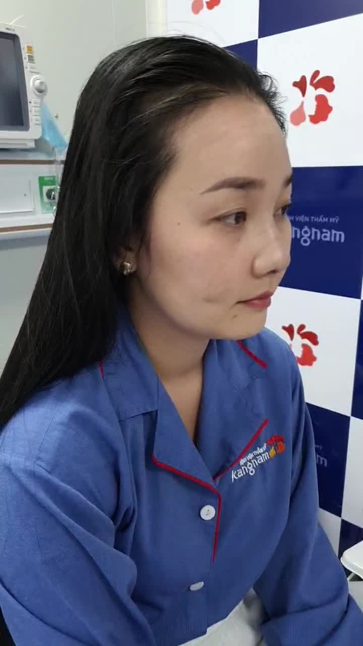 Tạm biệt mũi cũ - năm mới đón dáng mũi mới tự nhiên xinh đẹp