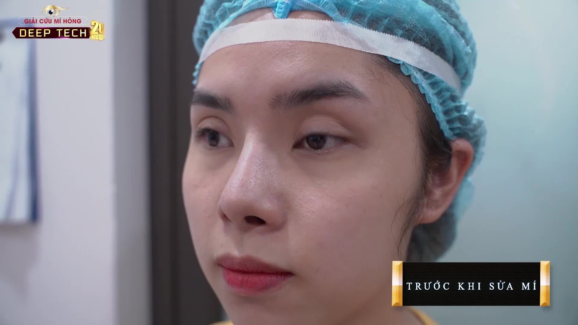 Khi khách hàng rơi vào tuyệt vọng, bế tắc, quyết định tới gặp Dr.Hải Lê và cái kết....Tết này có mí xinh đẹp.