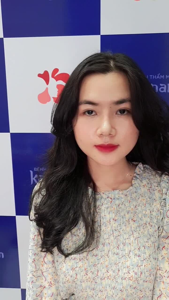 Cô nàng Gen Z lột xác sau combo Nâng mũi + Cắt mí