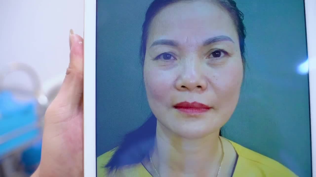 Sụp mí tuổi trung niên có cách nào khắc phục không Mời quý khách hàng cùng theo dõi video dưới đây để có câu trả lời!